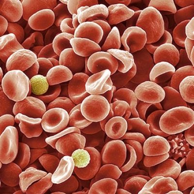 Platelet Rich Plasma