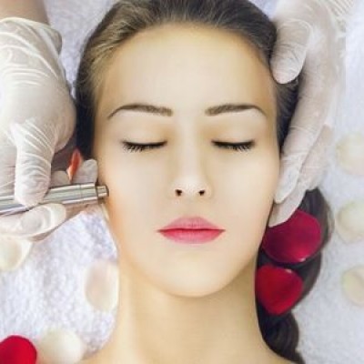 Shining Peel Laser